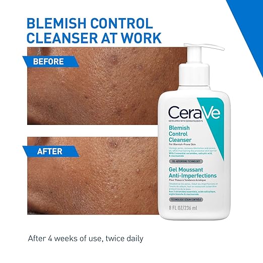 Cerave - Blemish Control Face Cleanser With 2 Salicylic Acid & Niacinamide For Blemish-Prone Skin 236Ml