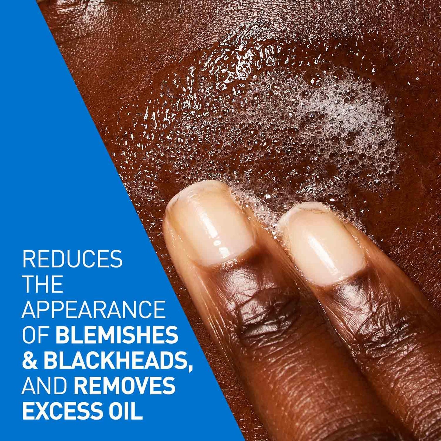 Cerave - Blemish Control Face Cleanser With 2 Salicylic Acid & Niacinamide For Blemish-Prone Skin 236Ml