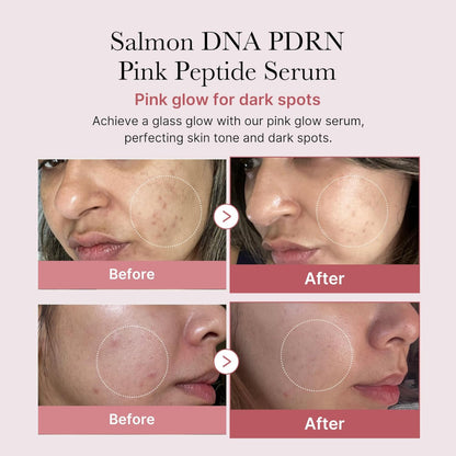 Medicube - PDRN Pink Peptide Serum 30ml